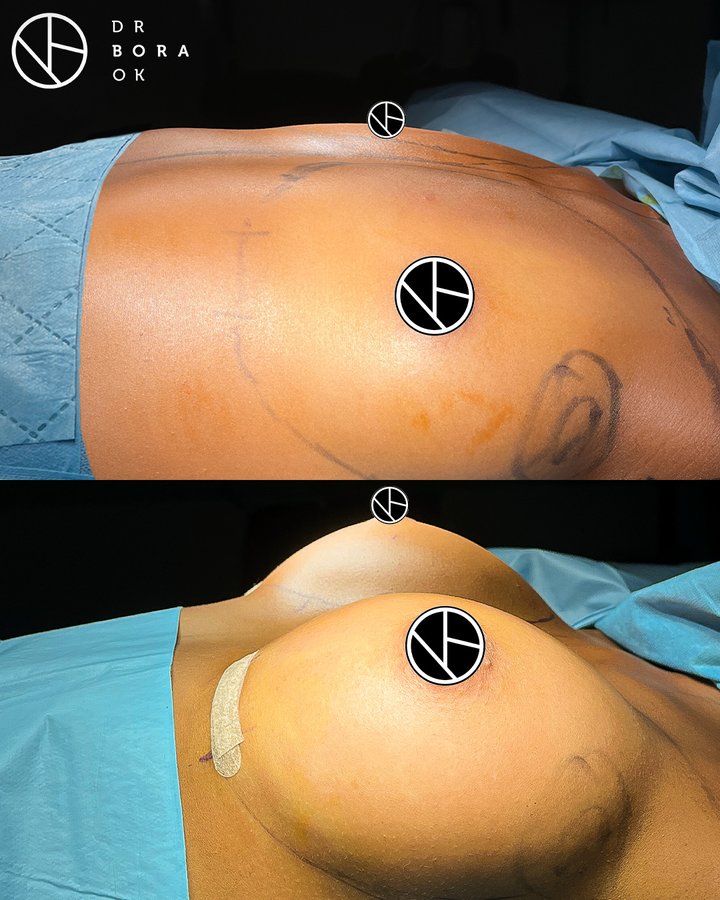 Dr. Bora Ok - Aesthetic Plastic Surgery Clinic - Dr. Bora Ok - Aesthetic Plastic Surgery Clinic