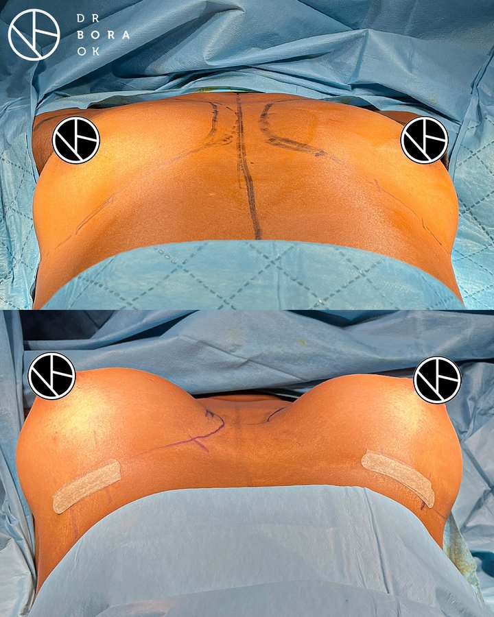 Dr. Bora Ok - Aesthetic Plastic Surgery Clinic - Dr. Bora Ok - Aesthetic Plastic Surgery Clinic