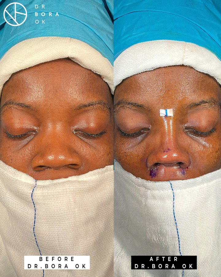 Dr. Bora Ok - Aesthetic Plastic Surgery Clinic - Dr. Bora Ok - Aesthetic Plastic Surgery Clinic