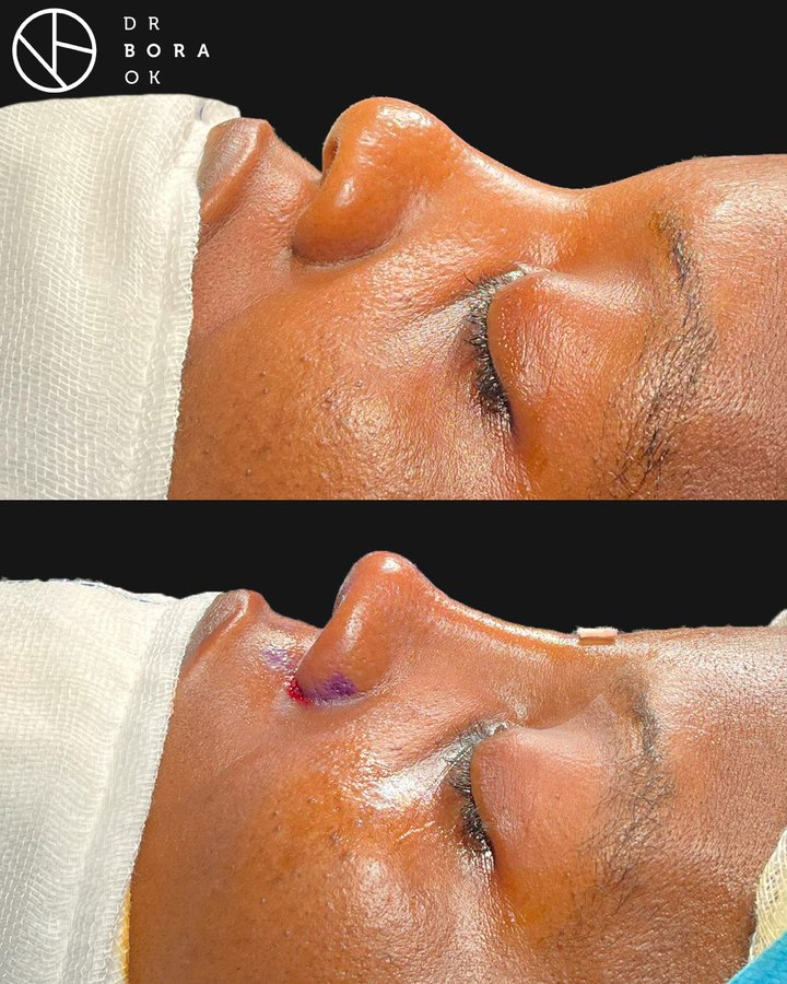 Dr. Bora Ok - Aesthetic Plastic Surgery Clinic - Dr. Bora Ok - Aesthetic Plastic Surgery Clinic