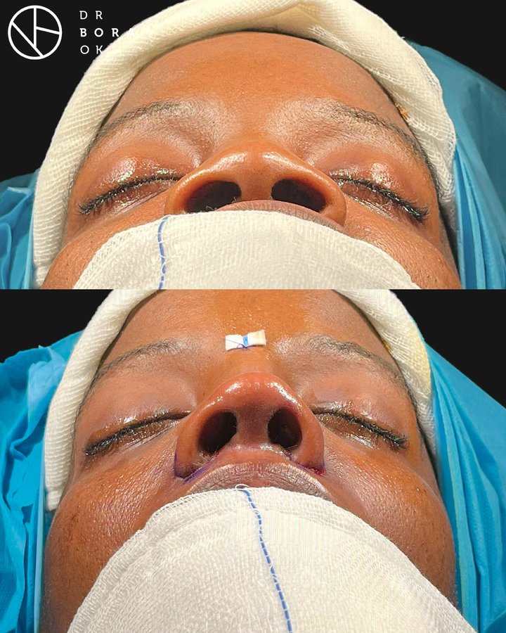 Dr. Bora Ok - Aesthetic Plastic Surgery Clinic - Dr. Bora Ok - Aesthetic Plastic Surgery Clinic