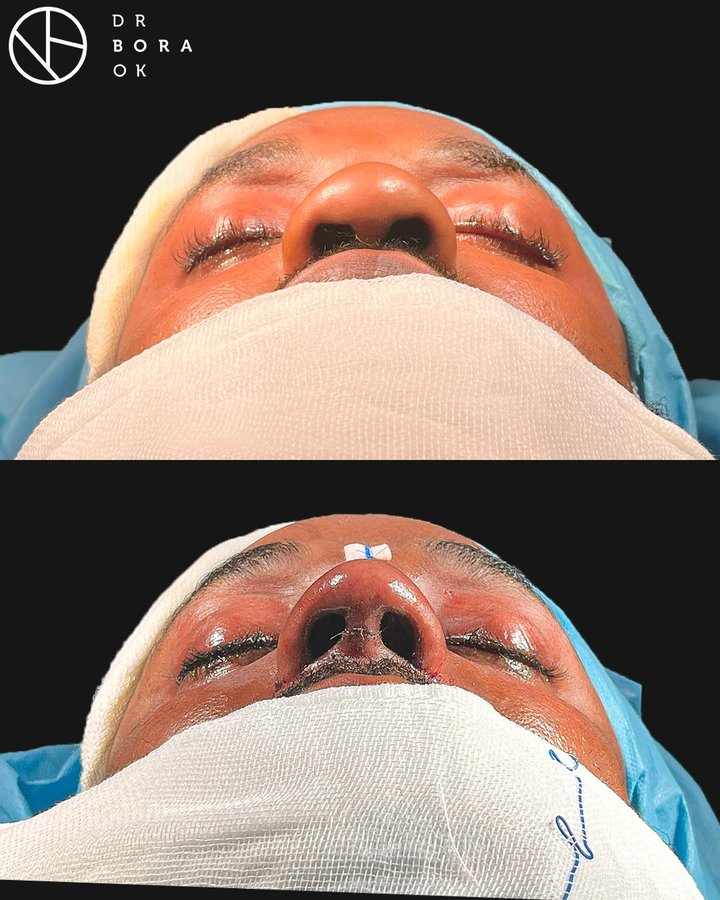 Dr. Bora Ok - Aesthetic Plastic Surgery Clinic - Dr. Bora Ok - Aesthetic Plastic Surgery Clinic