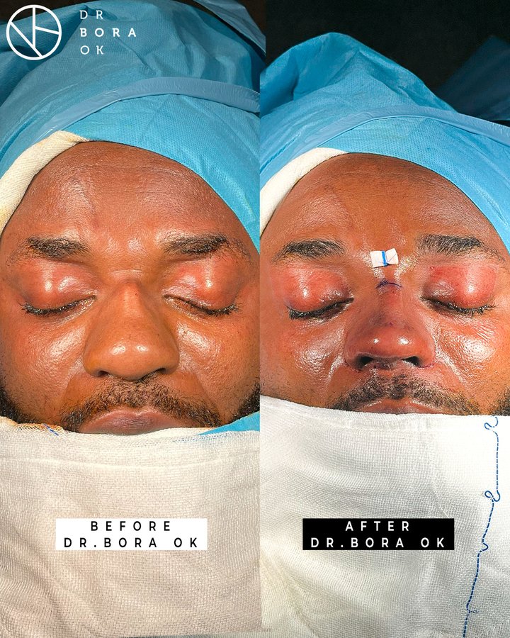 Dr. Bora Ok - Aesthetic Plastic Surgery Clinic - Dr. Bora Ok - Aesthetic Plastic Surgery Clinic