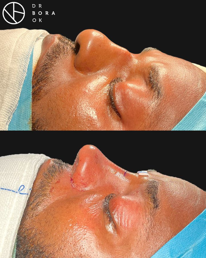 Dr. Bora Ok - Aesthetic Plastic Surgery Clinic - Dr. Bora Ok - Aesthetic Plastic Surgery Clinic