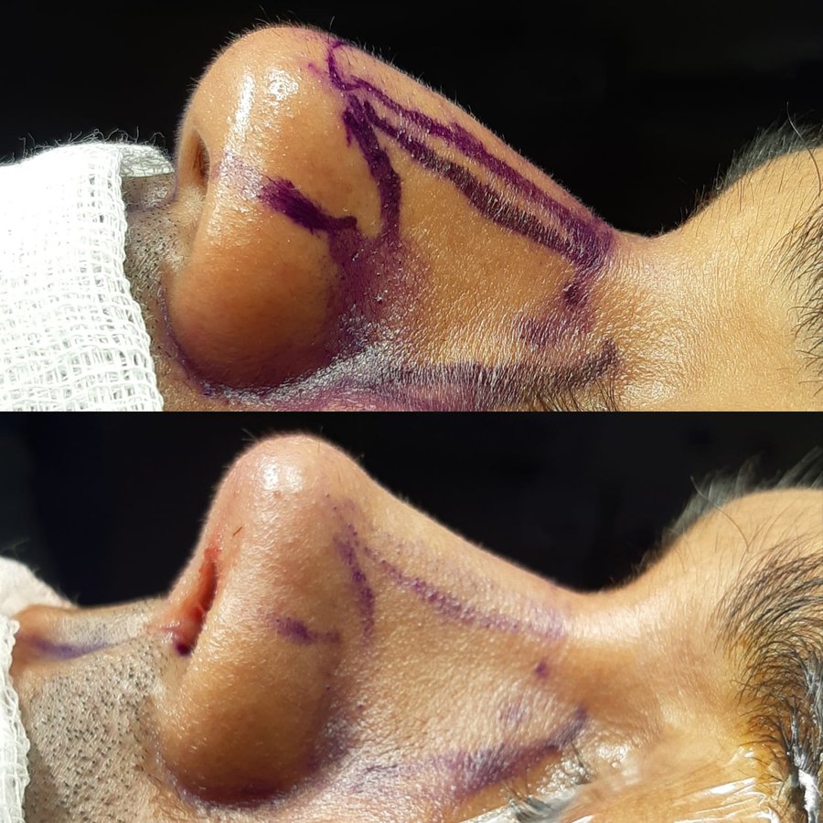 Dr. Bora Ok - Aesthetic Plastic Surgery Clinic - Dr. Bora Ok - Aesthetic Plastic Surgery Clinic