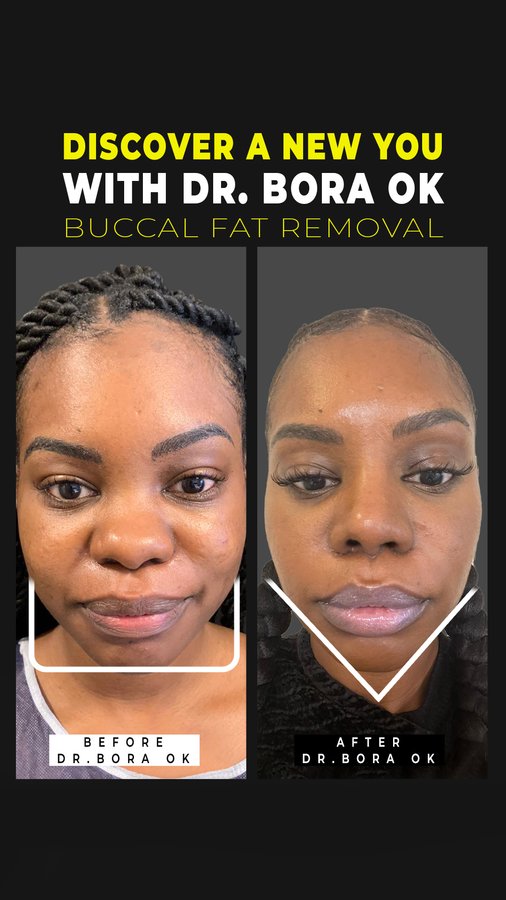 Dr. Bora Ok - Aesthetic Plastic Surgery Clinic - Dr. Bora Ok - Aesthetic Plastic Surgery Clinic