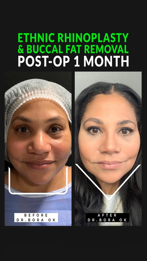 Dr. Bora Ok - Aesthetic Plastic Surgery Clinic - Dr. Bora Ok - Aesthetic Plastic Surgery Clinic