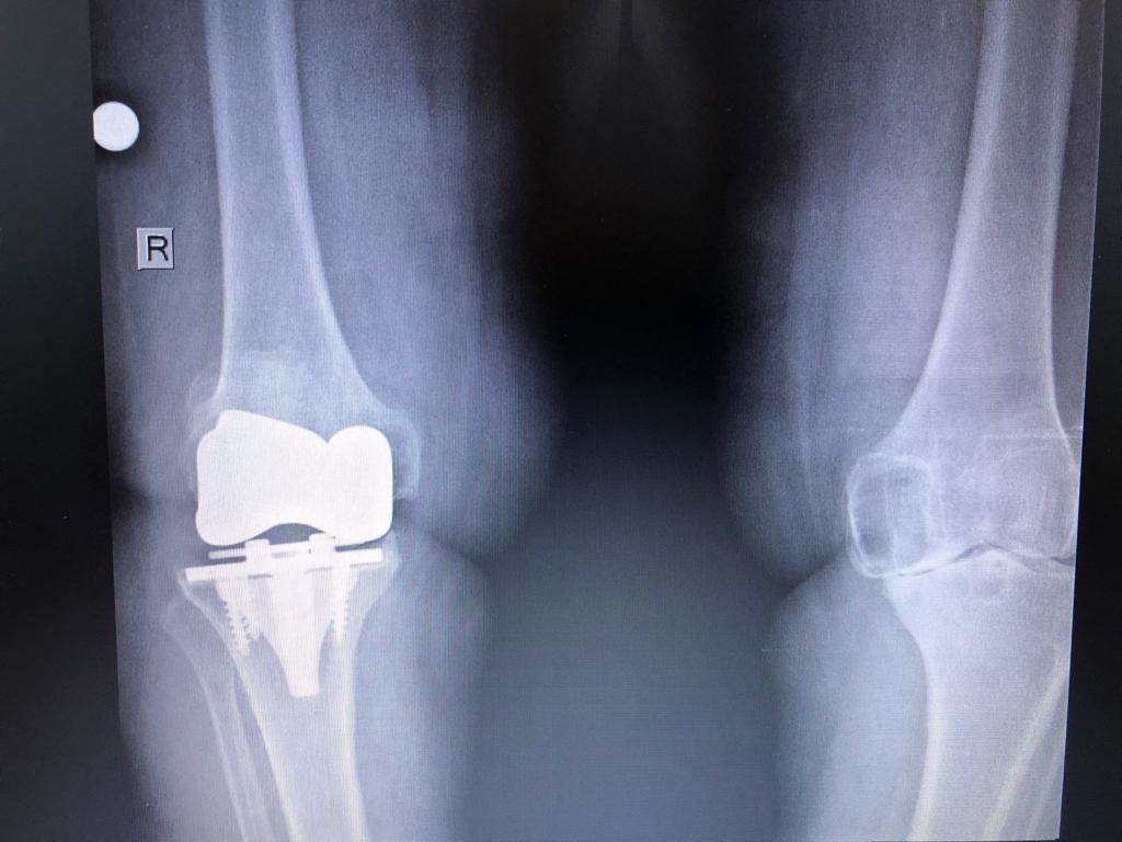 Dr. Bora Serifhan Alpaydin Orthopaedic Center - Dr. Bora Serifhan Alpaydin Orthopaedic Center