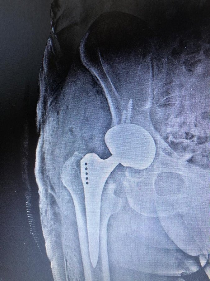 Dr. Bora Serifhan Alpaydin Orthopaedic Center - Dr. Bora Serifhan Alpaydin Orthopaedic Center