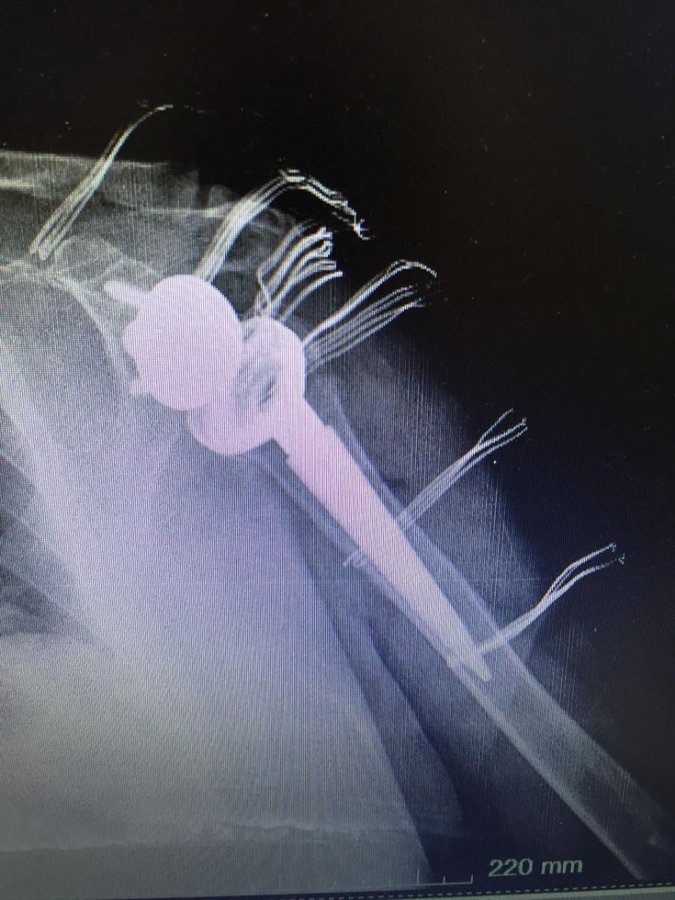 Dr. Bora Serifhan Alpaydin Orthopaedic Center - Dr. Bora Serifhan Alpaydin Orthopaedic Center