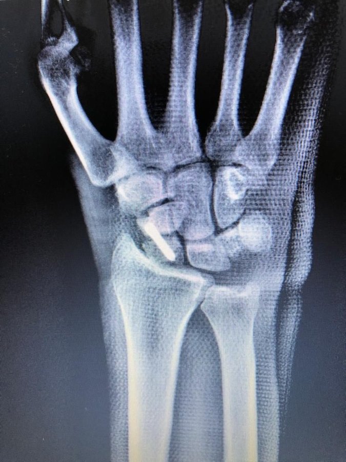 Dr. Bora Serifhan Alpaydin Orthopaedic Center - Dr. Bora Serifhan Alpaydin Orthopaedic Center