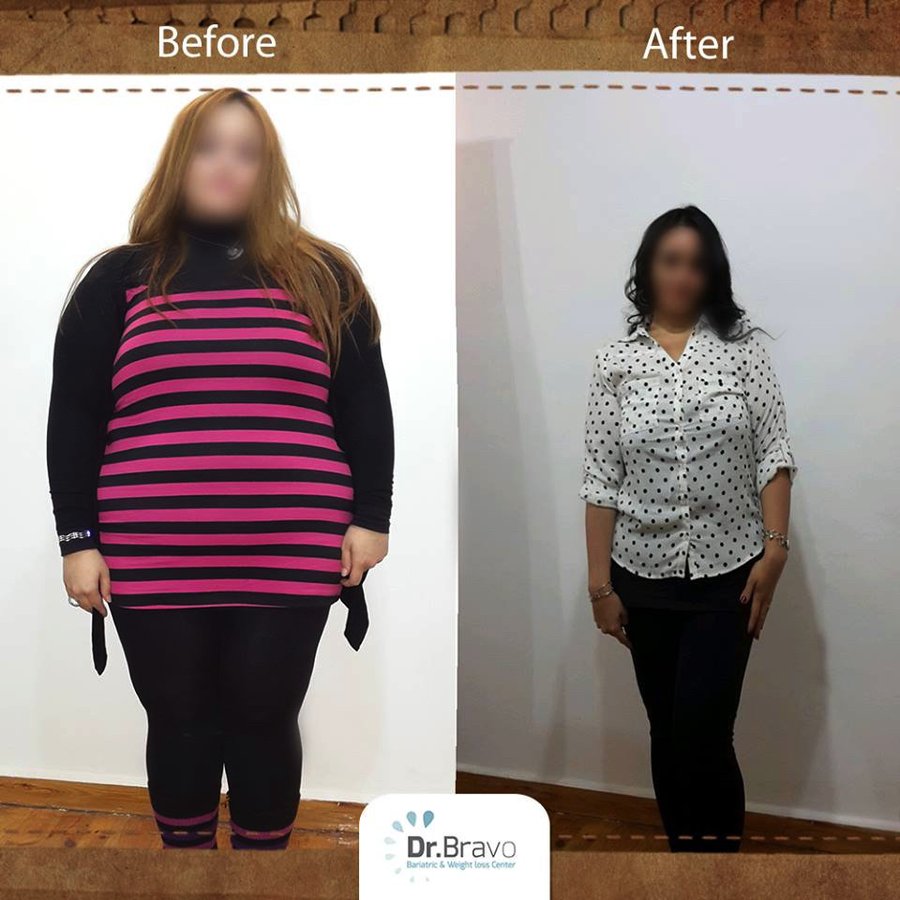 Dr. Bravo Bariatric and Weight Loss Center - Dr. Bravo Bariatric and Weight Loss Center