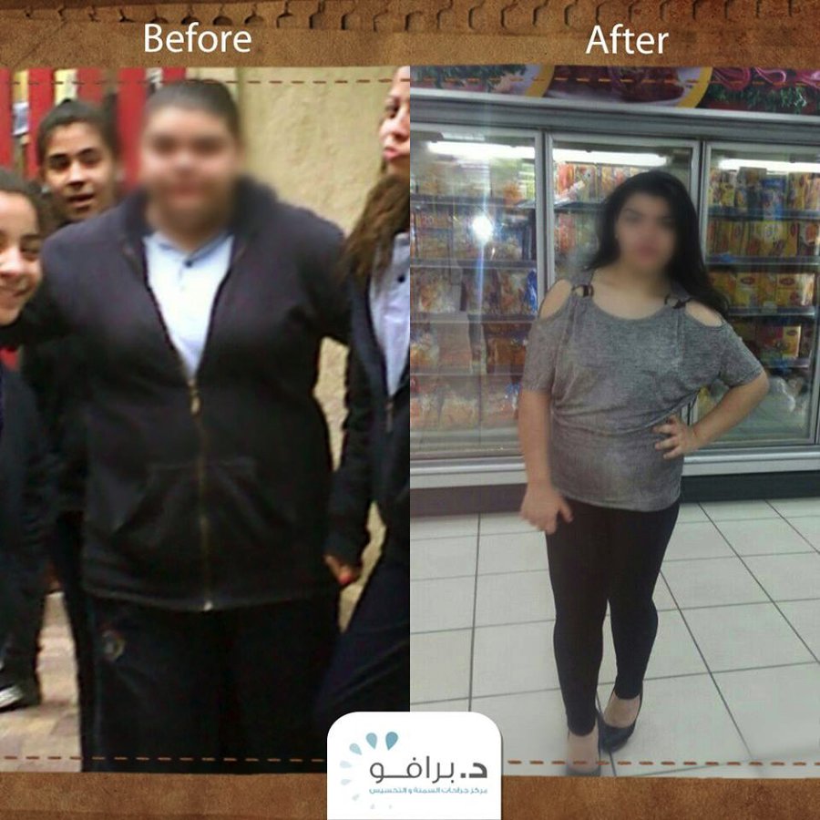 Dr. Bravo Bariatric and Weight Loss Center - Dr. Bravo Bariatric and Weight Loss Center