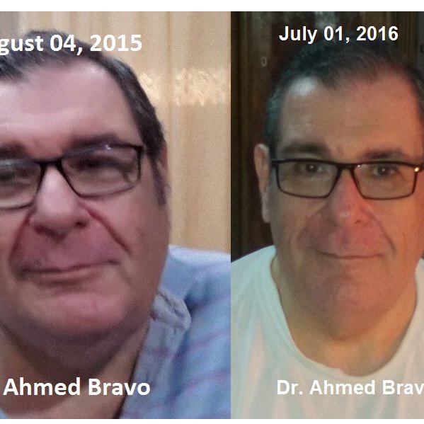 Dr. Bravo Bariatric and Weight Loss Center - Dr. Bravo Bariatric and Weight Loss Center