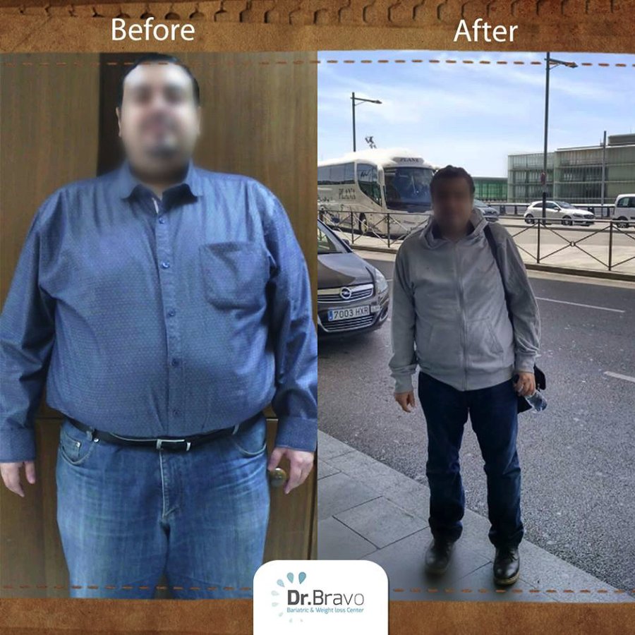 Dr. Bravo Bariatric and Weight Loss Center - Dr. Bravo Bariatric and Weight Loss Center