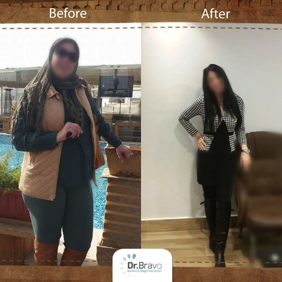 Dr. Bravo Bariatric and Weight Loss Center - Dr. Bravo Bariatric and Weight Loss Center