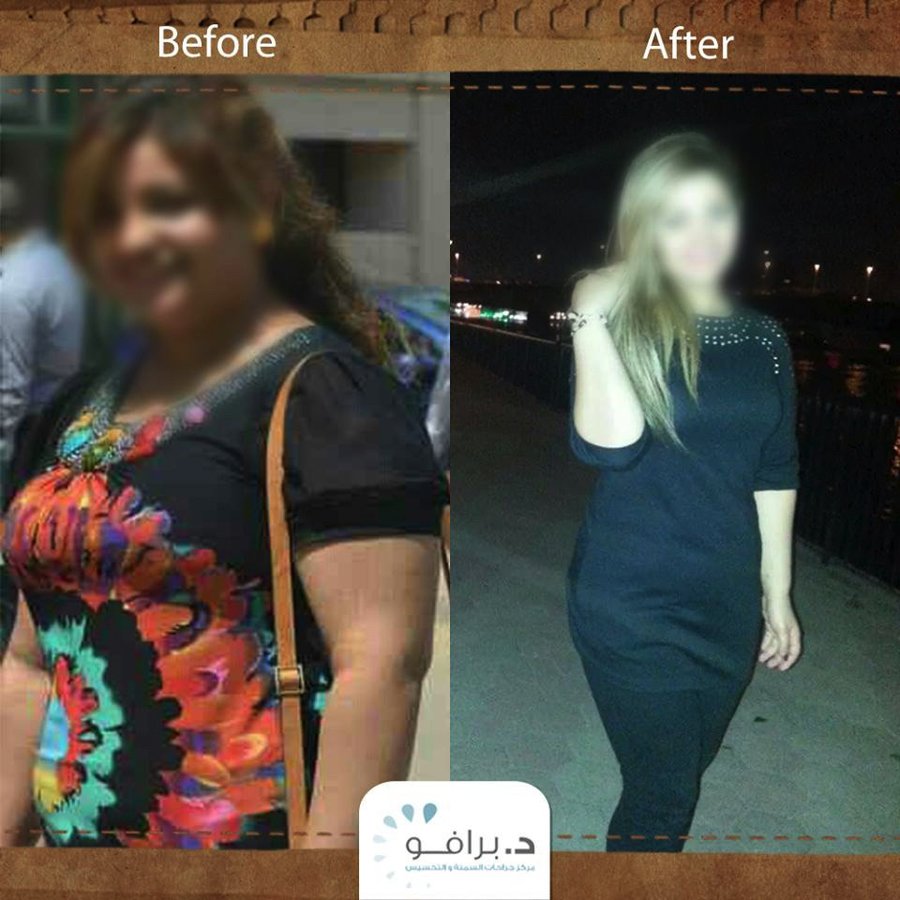 Dr. Bravo Bariatric and Weight Loss Center - Dr. Bravo Bariatric and Weight Loss Center