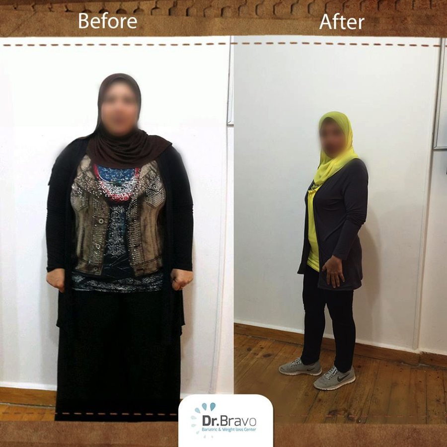 Dr. Bravo Bariatric and Weight Loss Center - Dr. Bravo Bariatric and Weight Loss Center