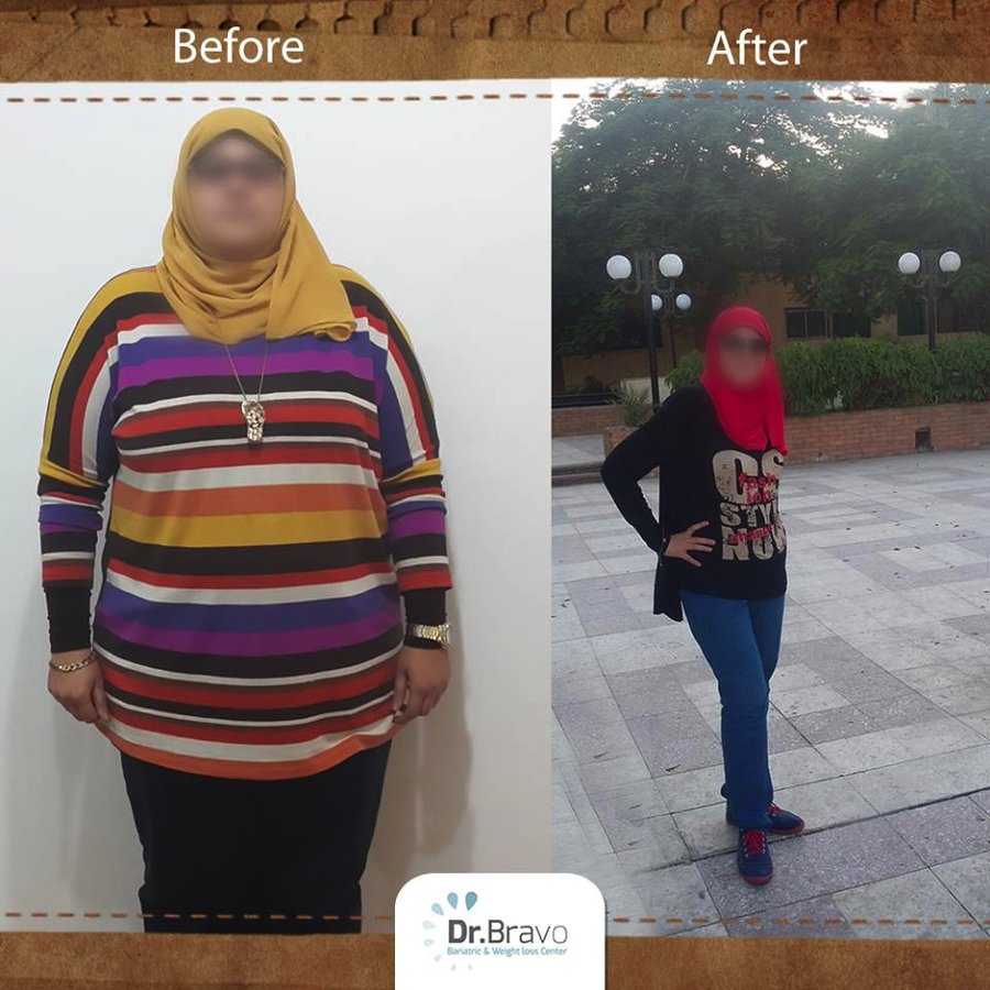 Dr. Bravo Bariatric and Weight Loss Center - Dr. Bravo Bariatric and Weight Loss Center