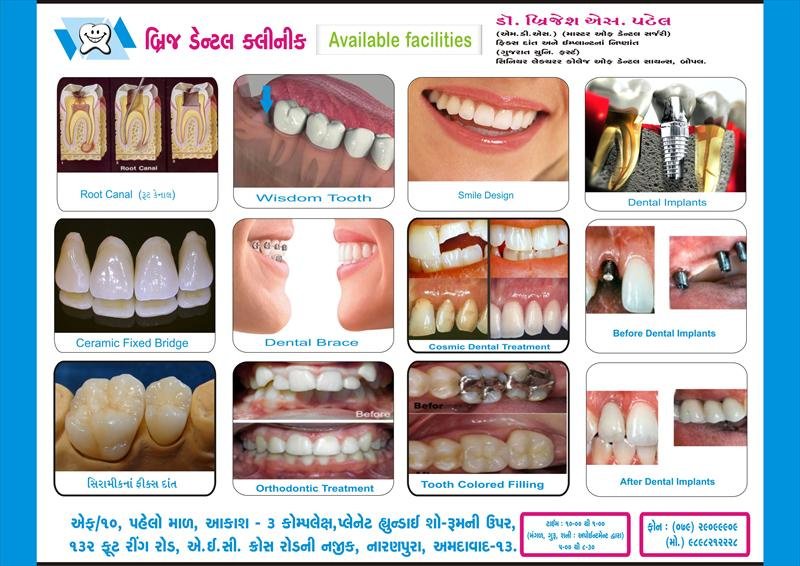 Dr Brijesh Patel’s Brij Dental Clinic & Implant ce - Dr Brijesh Patel’s Brij Dental Clinic & Implant ce