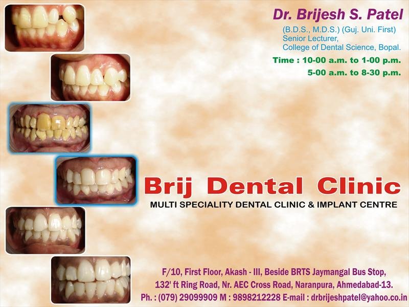 Dr Brijesh Patel’s Brij Dental Clinic & Implant ce - Dr Brijesh Patel’s Brij Dental Clinic & Implant ce