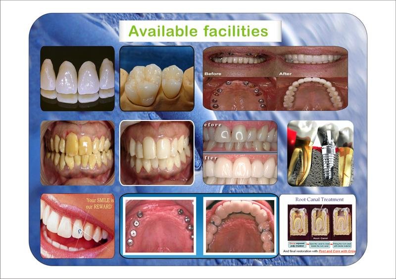 Dr Brijesh Patel’s Brij Dental Clinic & Implant ce - Dr Brijesh Patel’s Brij Dental Clinic & Implant ce