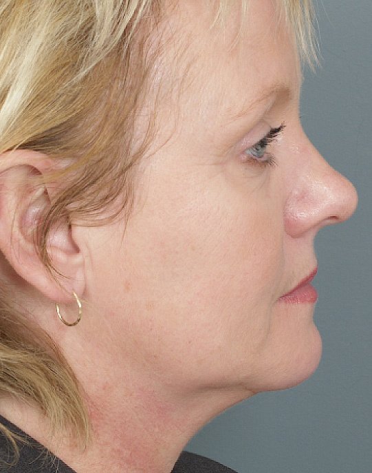 Dr Bryan C Mendelson - Dr Bryan C Mendelson