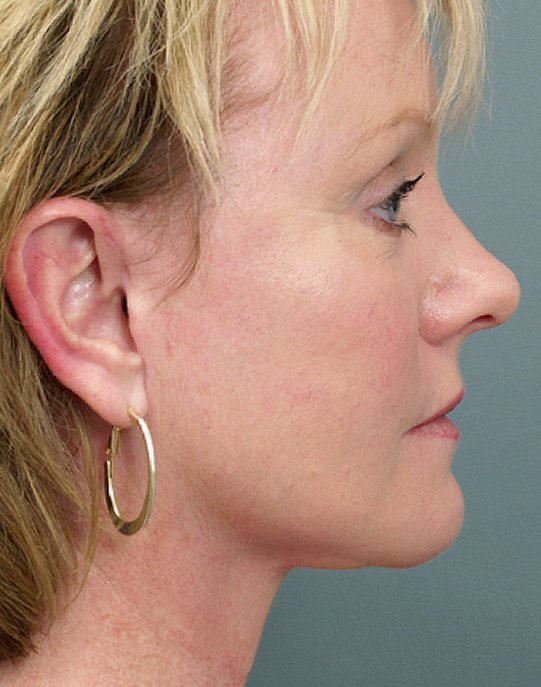 Dr Bryan C Mendelson - Dr Bryan C Mendelson