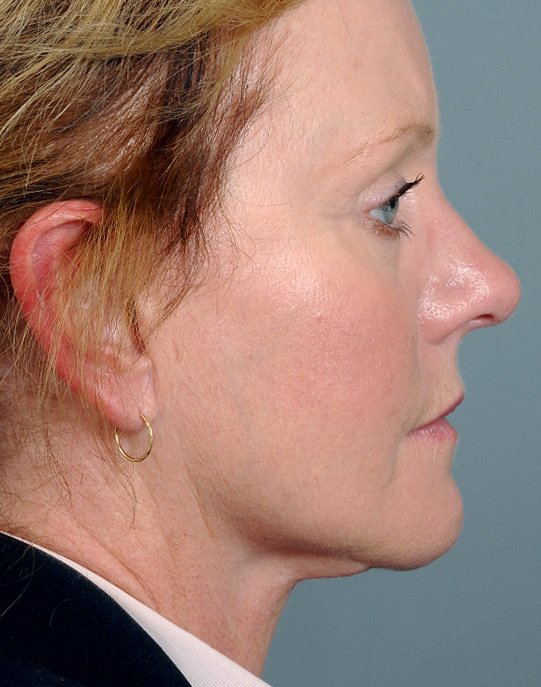 Dr Bryan C Mendelson - Dr Bryan C Mendelson