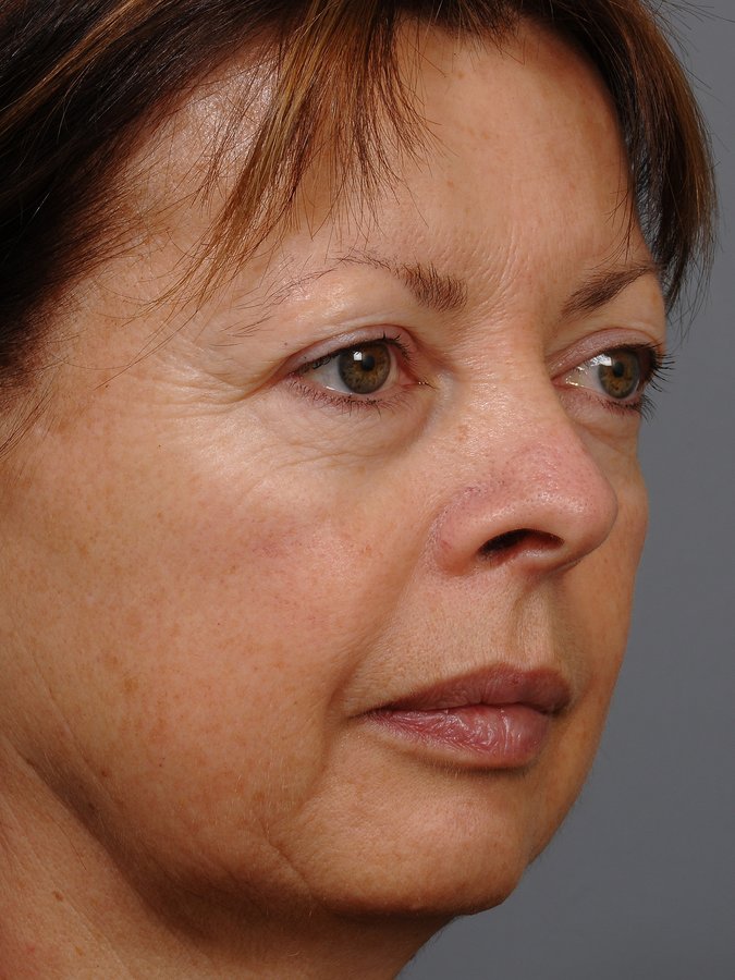 Dr Bryan C Mendelson - Dr Bryan C Mendelson