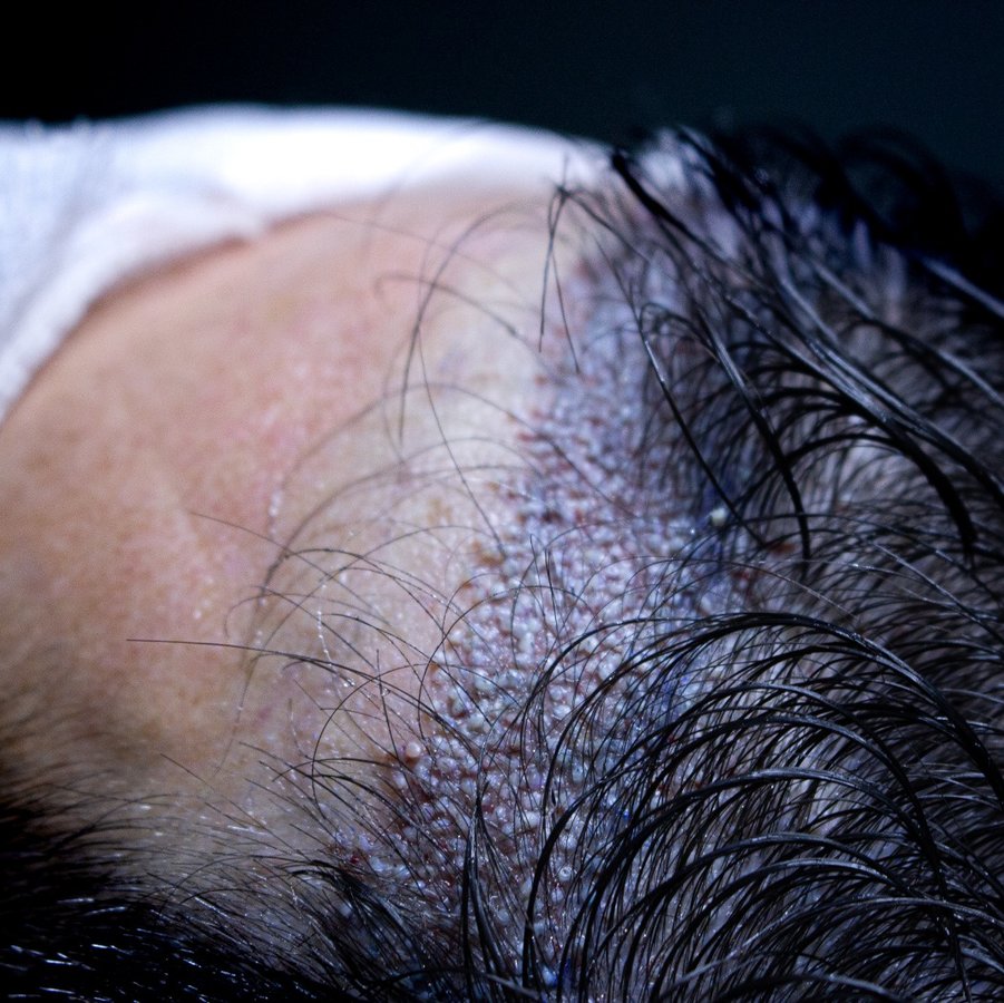 Dr. Can Aesthetic - Dr. Can Aesthetic