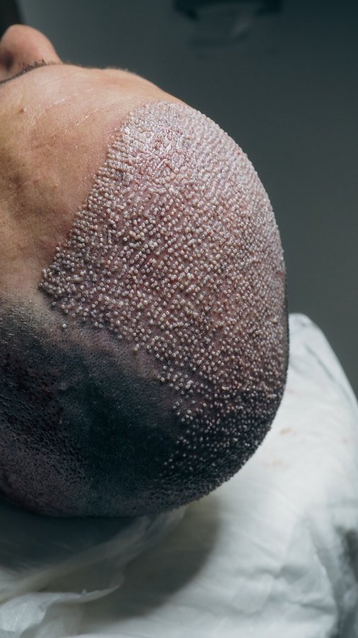 Dr. Can Aesthetic - Dr. Can Aesthetic