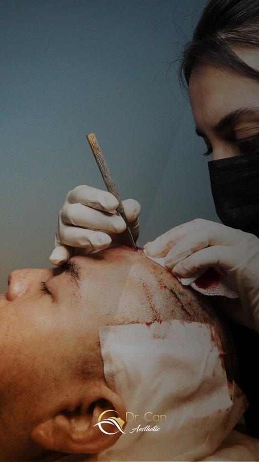 Dr. Can Aesthetic - Dr. Can Aesthetic