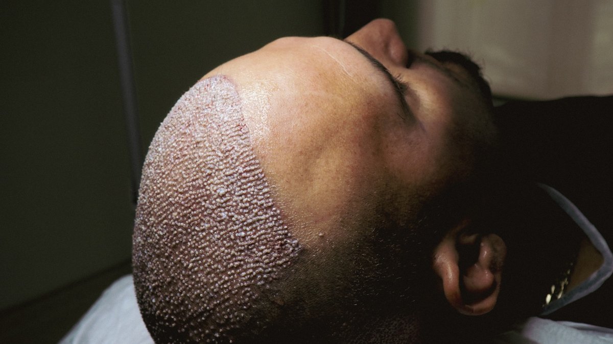 Dr. Can Aesthetic - Dr. Can Aesthetic