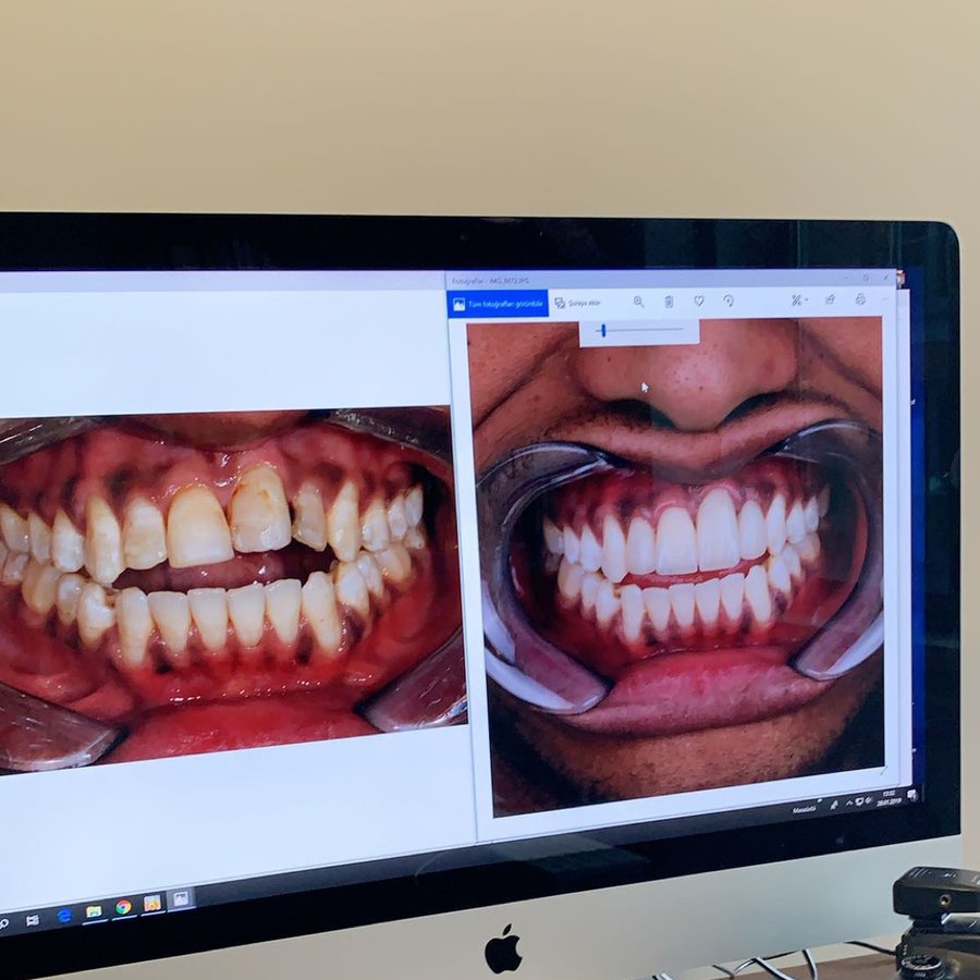 Dr. Can Yenigun- Periodontology Specialist - Dr. Can Yenigun- Periodontology Specialist