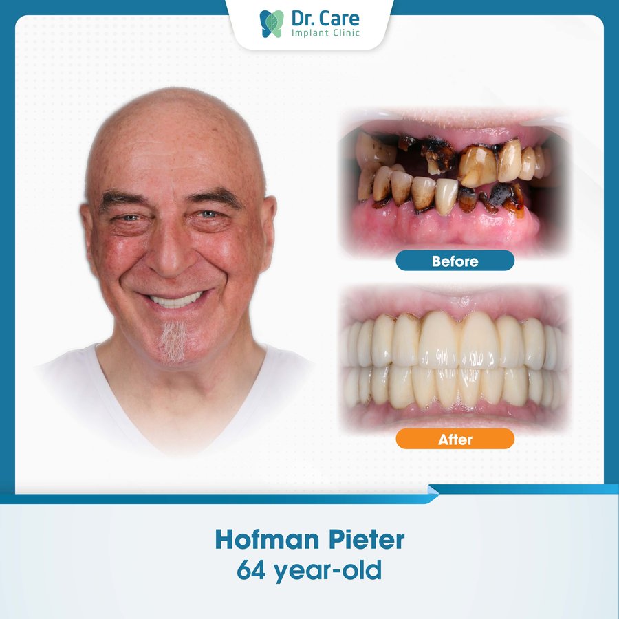 Dr. Care Implant Clinic - Vietnam - Dr. Care Implant Clinic - Vietnam