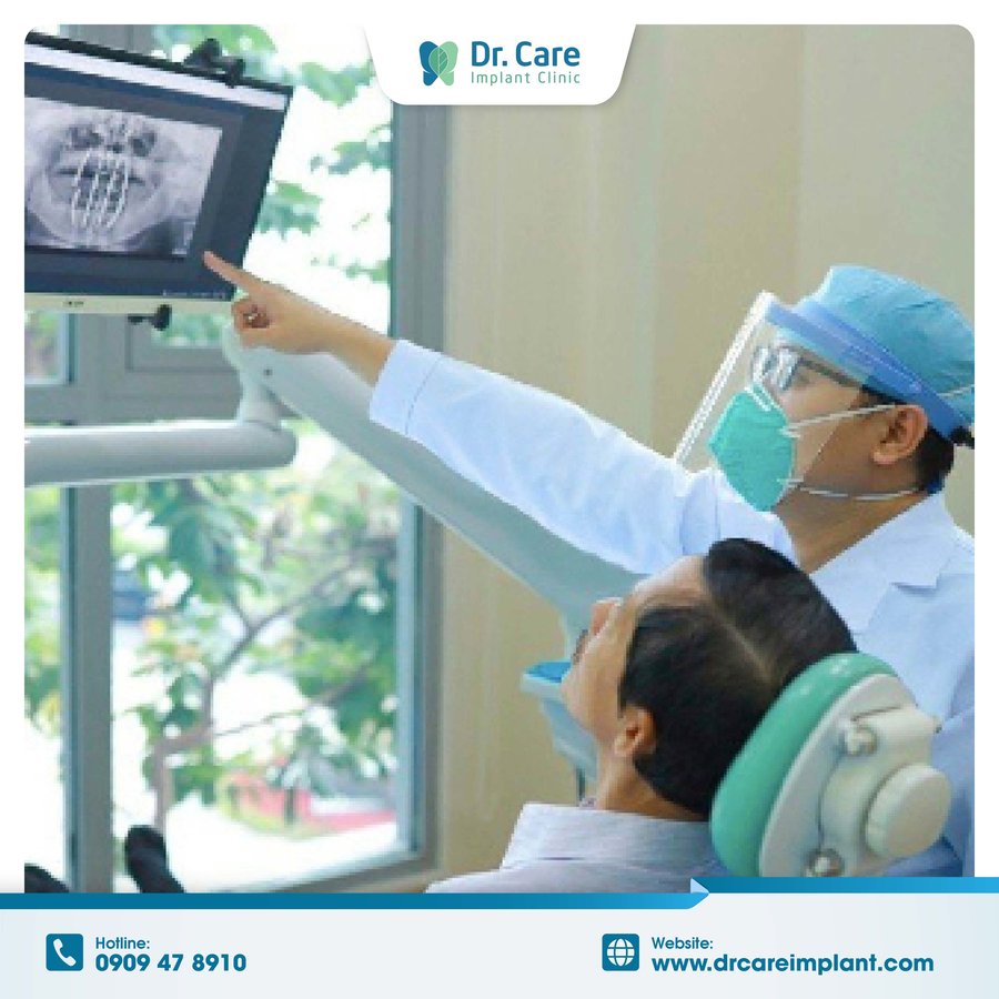 Dr. Care Implant Clinic - Vietnam - Dr. Care Implant Clinic - Vietnam