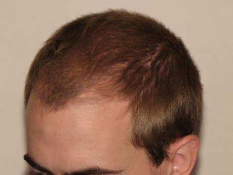 Dr. Carlos Alejos - Dr. Carlos Alejos