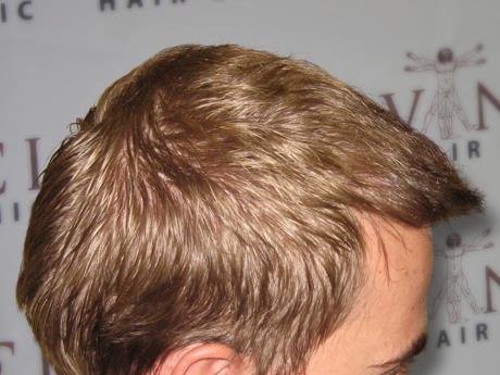 Dr. Carlos Alejos - Dr. Carlos Alejos