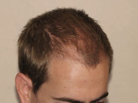 Dr. Carlos Alejos - Dr. Carlos Alejos