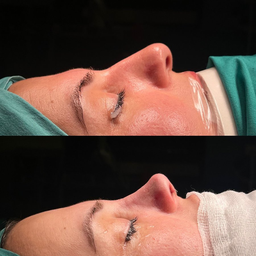 Dr. Cem Berkay SINACI - Dr. Cem Berkay SINACI