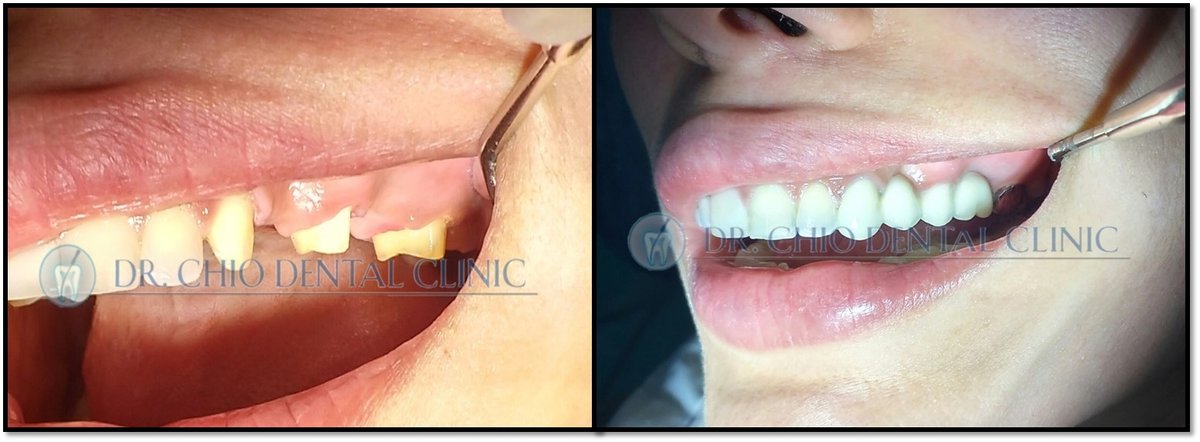 Dr Chio Dental Clinic - Dr Chio Dental Clinic