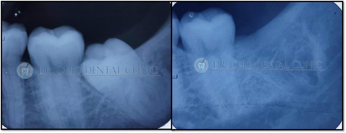 Dr Chio Dental Clinic - Dr Chio Dental Clinic