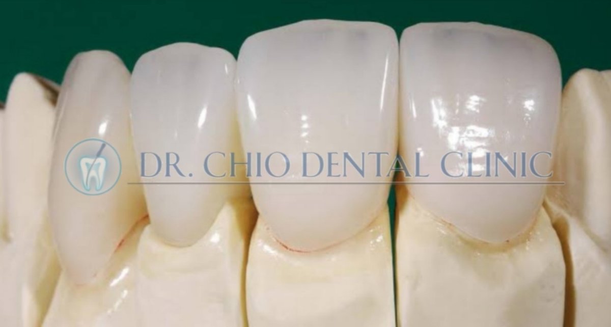 Dr Chio Dental Clinic - Dr Chio Dental Clinic