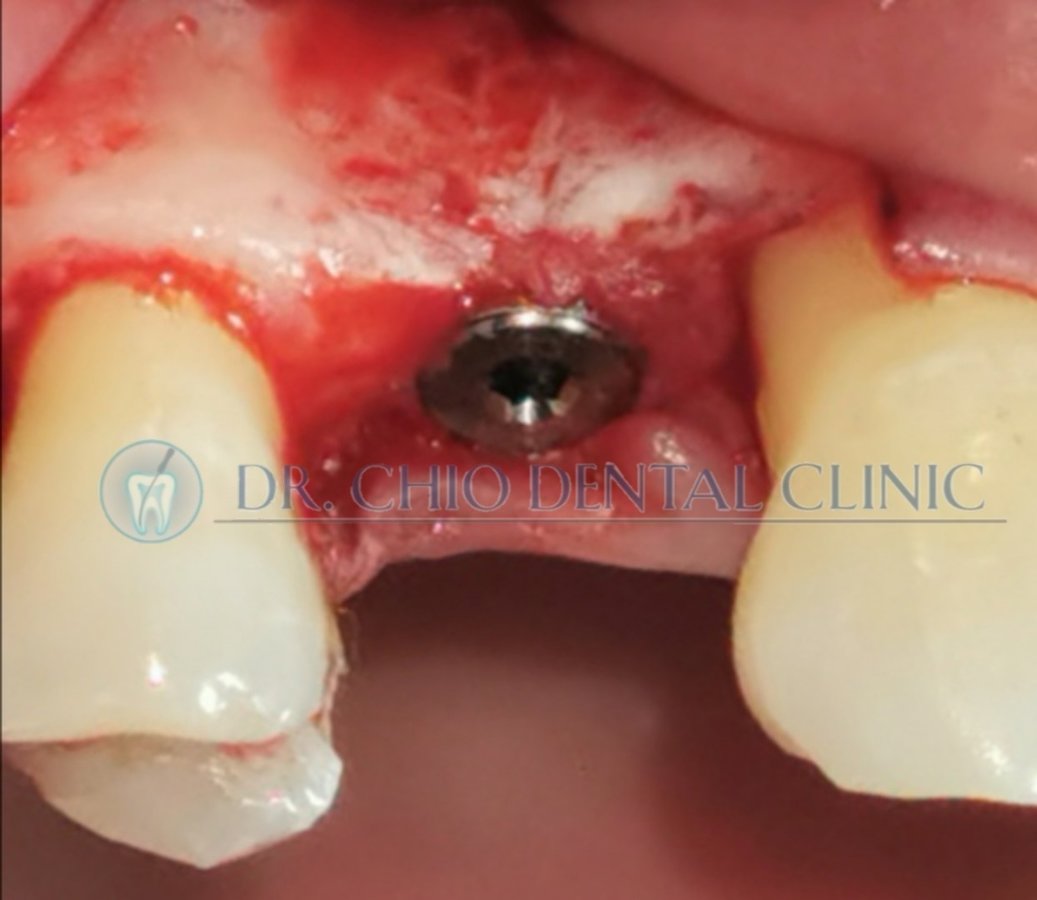 Dr Chio Dental Clinic - Dr Chio Dental Clinic