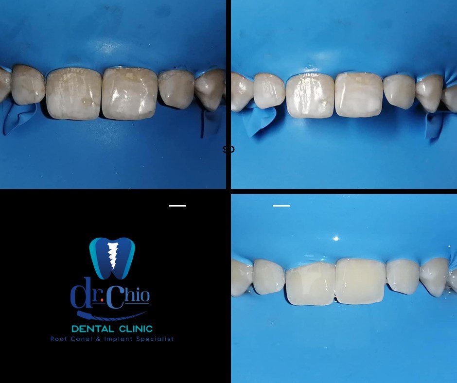 Dr Chio Dental Clinic - Dr Chio Dental Clinic