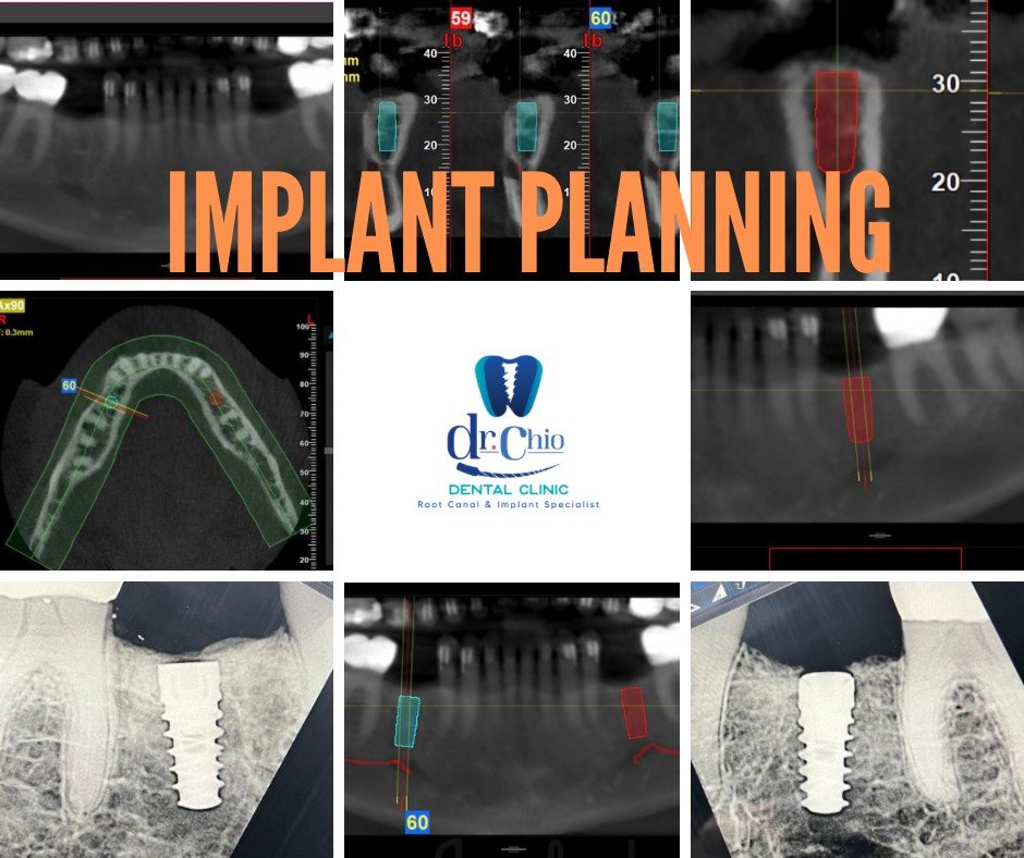 Dr Chio Dental Clinic - Dr Chio Dental Clinic