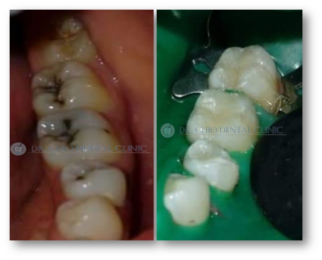 Dr Chio Dental Clinic - Dr Chio Dental Clinic