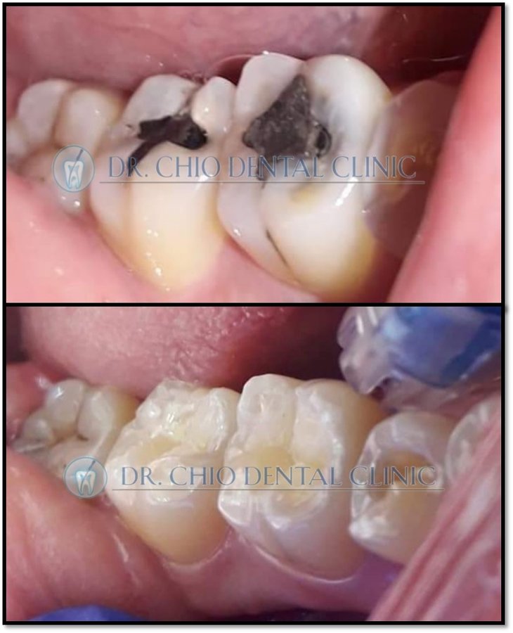 Dr Chio Dental Clinic - Dr Chio Dental Clinic