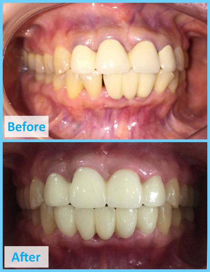 Dr. Chour Darith - Dr. Chour Darith